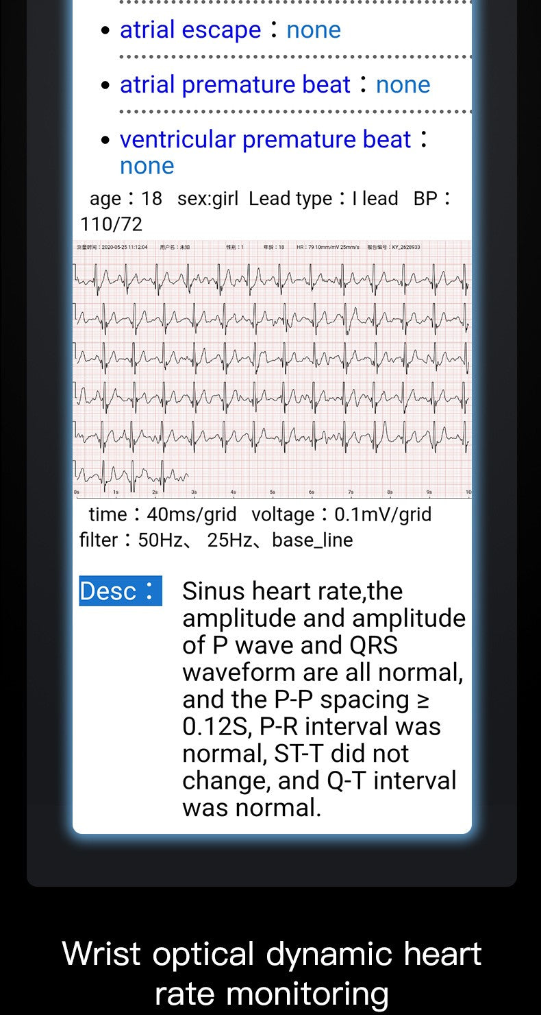 Smartband EFFEOKKI com Monitor ECG e PPG — imagem 8 de 19